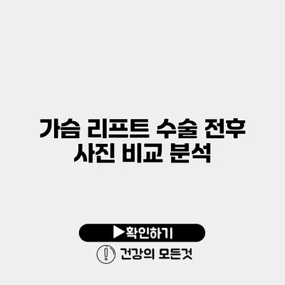 가슴 리프트 수술 전후 사진 비교 분석